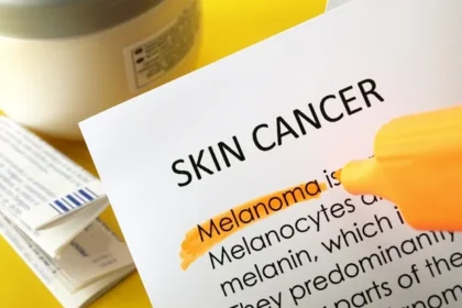 EADV Congress: Non-melanoma skin cancer killing more people than melanoma, new study finds